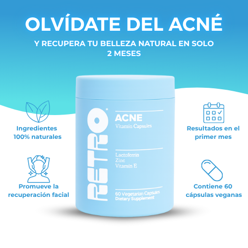 RETRO ACNÉ™ | Elimina el acné y recupera tu confianza